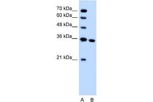 WB Suggested Anti-SLC25A29 Antibody Titration:  1. (SLC25A29 Antikörper  (C-Term))