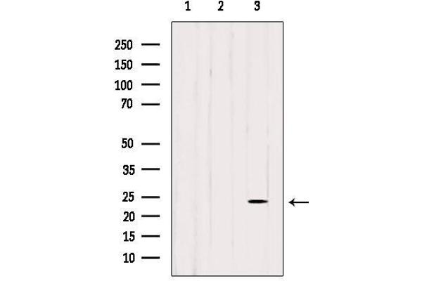 CDC42EP3 Antikörper  (Internal Region)