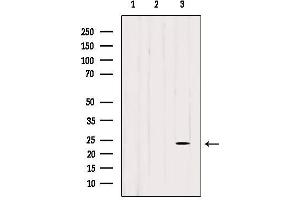 Western blot analysis of extracts from various samples, using BORG2 Antibody.