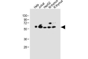 All lanes : Anti-PDCD4 Antibody (Center) at 1:2000 dilution Lane 1: Hela whole cell lysate Lane 2: Jurkat whole cell lysate Lane 3: HepG2 whole cell lysate Lane 4: Mouse thymus tissue lysate Lane 5: Rat thymus tissue lysate Lysates/proteins at 20 μg per lane. (PDCD4 Antikörper  (AA 121-149))