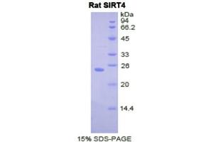 SDS-PAGE analysis of Rat Sirtuin 4 Protein.