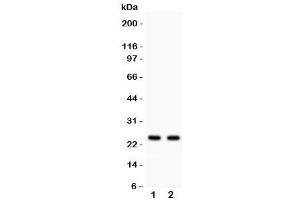Western blot testing of Rab3A antibody and Lane 1:  rat brain (RAB3A Antikörper  (AA 192-220))