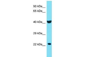 Host: Rabbit Target Name: C4orf51 Sample Type: 721_B Whole Cell lysates Antibody Dilution: 1. (C4ORF51 Antikörper  (C-Term))