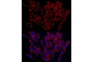 Immunofluorescence analysis of C6 cells using SURF4 Rabbit pAb (ABIN7270650) at dilution of 1:100 (40x lens). (Surfeit 4 Antikörper  (AA 50-150))