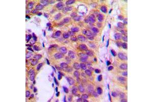 Immunohistochemistry (IHC) image for anti-phospholipase C, gamma 1 (PLCG1) (Center) antibody (ABIN7296610)