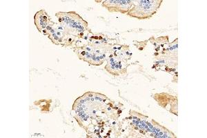 Immunohistochemistry of paraffin embedded mouse duodenum using MAL2 (ABIN7074549) at dilution of 1: 700 (400x lens) (MAL2 Antikörper)