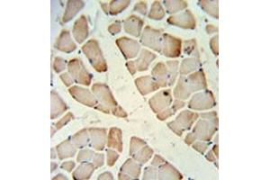 Immunohistochemistry analysis in formalin fixed and paraffin embedded skeletal muscle reacted with HFE2 / Hemojuvelin Antibody (Center) followed which was peroxidase conjugated to the secondary antibody and followed by DAB staining.