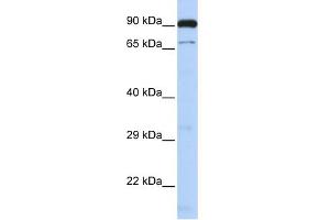 WB Suggested Anti-CTCFL Antibody Titration:  0. (CTCFL Antikörper  (N-Term))