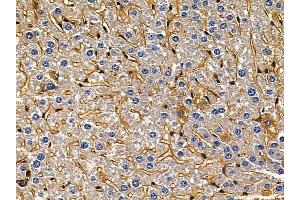 ABIN7094020 and ABIN7098064 at 1/100 staining mouse liver tissue by IHC-P. (TIMM17A Antikörper  (C-Term))