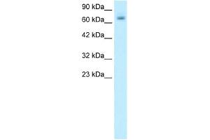 PARP2 antibody used at 1. (PARP2 Antikörper)