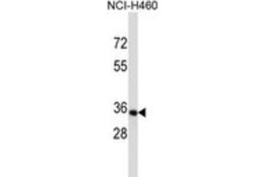 Western Blotting (WB) image for anti-Olfactory Receptor, Family 14, Subfamily C, Member 36 (OR14C36) antibody (ABIN5017126) (OR14C36 Antikörper)