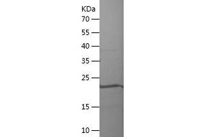 CCDC86 Protein (AA 189-360) (His tag)