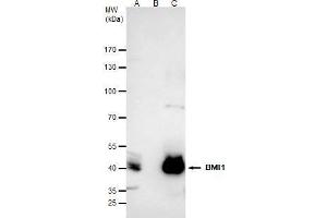 IP Image Bmi1 antibody immunoprecipitates Bmi1 protein in IP experiments. (BMI1 Antikörper  (Center))