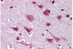 Human Brain, Cortex (formalin-fixed, paraffin-embedded) stained with MAPK9 antibody ABIN293094 at 20 ug/ml followed by biotinylated goat anti-rabbit IgG secondary antibody ABIN481713, alkaline phosphatase-streptavidin and chromogen. (JNK2 Antikörper  (N-Term))