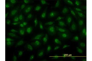Immunofluorescence of monoclonal antibody to PSCD3 on HeLa cell.