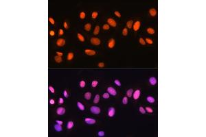 Immunofluorescence analysis of U-2 OS cells using Ku70 Rabbit mAb (ABIN7271407) at dilution of 1:100 (40x lens). (XRCC6 Antikörper)