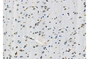 ABIN6265191 and ABIN6273164 at 1/100 staining Rat brain tissue by IHC-P. (SMOX Antikörper  (Internal Region))