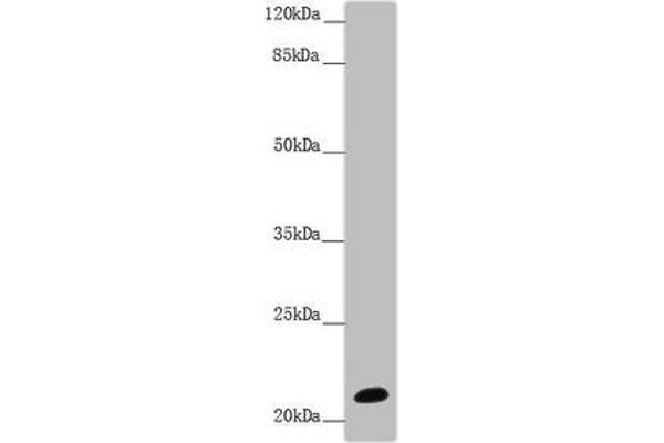NCALD Antikörper  (AA 1-193)
