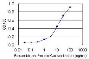 Detection limit for recombinant GST tagged CTBP1 is 0. (CTBP1 Antikörper  (AA 1-429))