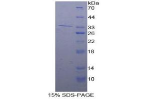 SDS-PAGE analysis of Mouse IRF4 Protein.