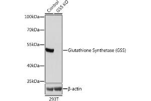 Western blot analysis of extracts from normal (control) and Glutathione Synthetase (Glutathione Synthetase (GSS)) knockout (KO) 293T cells, using Glutathione Synthetase (Glutathione Synthetase (GSS)) antibody (ABIN7267451) at 1:1000 dilution. (Glutathione Synthetase Antikörper  (AA 373-474))