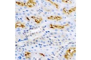 Immunohistochemical analysis of LC3B staining in rat kidney formalin fixed paraffin embedded tissue section. (LC3B Antikörper)