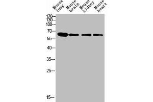 Western blot analysis of human blood lysate, antibody was diluted at 1000. (LGALS3BP Antikörper  (AA 100-160))