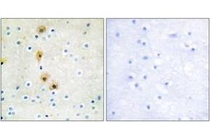 Immunohistochemistry analysis of paraffin-embedded human brain tissue, using Akt (Ab-326) Antibody.
