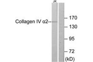 Western blot analysis of extracts from Jurkat cells, using Collagen IV alpha2 Antibody. (COL4a2 Antikörper  (AA 151-200))