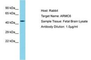 Image no. 1 for anti-Armadillo Repeat Containing 6 (ARMC6) (AA 157-206) antibody (ABIN6750737) (ARMC6 Antikörper  (AA 157-206))