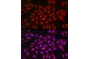 Immunofluorescence analysis of U2OS cells using PPARγ Rabbit pAb (ABIN3020843, ABIN3020844, ABIN3020845, ABIN1513399 and ABIN6213752) at dilution of 1:200 (40x lens). (PPARG Antikörper  (AA 50-150))
