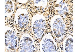 anti-Chromobox Homolog 4 (CBX4) (Internal Region) antibody