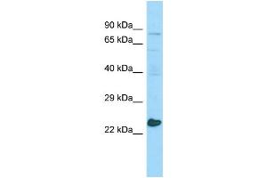 WB Suggested Anti-MED20 Antibody Titration: 1. (MED20 Antikörper  (Middle Region))