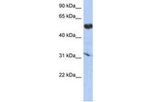 Image no. 1 for anti-Cytochrome P450, Family 4, Subfamily X, Polypeptide 1 (CYP4X1) (AA 287-336) antibody (ABIN6743879) (CYP4X1 Antikörper  (AA 287-336))