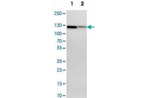 Western blot analysis of cell lysates with NFKB2 polyclonal antibody  at 1:250-1:500 dilution. (NFKB2 Antikörper)