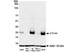 Western Blotting (WB) image for anti-Cytotoxic T-Lymphocyte-Associated Protein 4 (CTLA4) (C-Term) antibody (ABIN7795650)