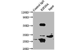 Immunoprecipitating KIF20A in 293 whole cell lysate Lane 1: Rabbit control IgG (1 μg) instead of ABIN7157612 in 293 whole cell lysate. (KIF2A Antikörper  (AA 161-294))
