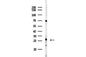 anti-Calcium Binding Protein 5 (CABP5) (N-Term) antibody