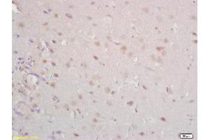 Formalin-fixed and paraffin embedded rat brain labeled with Anti Tomoregulin-1 Polyclonal Antibody, Unconjugated (ABIN762686) at 1:200 followed by conjugation to the secondary antibody and DAB staining (TMEFF1 Antikörper  (AA 65-160))