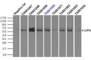 Image no. 2 for anti-Lipase, Endothelial (LIPG) antibody (ABIN1499176) (LIPG Antikörper)