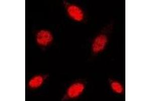 Immunofluorescent analysis of RB1 staining in HuvEc cells.