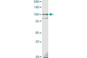 TLR9 monoclonal antibody (M04), clone 3B7 Western Blot analysis of TLR9 expression in IMR-32 .