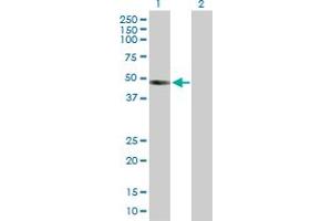Western Blotting (WB) image for INHBB 293T Cell Transient Overexpression Lysate(Denatured) (ABIN1332376)