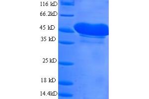 SDS-PAGE (SDS) image for Mesothelin (MSLN) (AA 298-600), (cleaved) protein (His tag) (ABIN5713670)