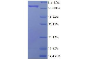 SDS-PAGE (SDS) image for Phosphoglucomutase 3 (PGM3) (AA 1-542), (full length) protein (His-SUMO Tag) (ABIN5710087)