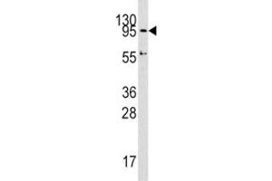 Western blot analysis of Dnmt3a antibody and HepG2 lysate. (DNMT3A Antikörper  (AA 723-752))