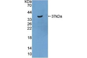Western blot analysis of recombinant Human STATH. (STATH Antikörper  (AA 1-62))