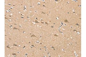 The image on the left is immunohistochemistry of paraffin-embedded Human brain tissue using ABIN7192347(SGPL1 Antibody) at dilution 1/25, on the right is treated with synthetic peptide. (SGPL1 Antikörper)