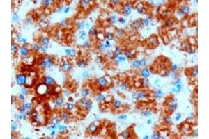 IHC testing of FFPE human liver with DGAT2 antibody at 3ug/ml. (DGAT2 Antikörper)