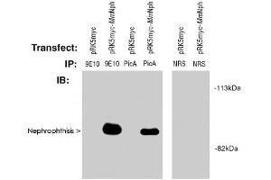 Western blot of Nephrophthisis (pic) polyclonal antibody  used at 2! (NPHP1 Antikörper  (AA 612-691))